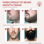 Ivory Natural Beard Growth Cream - Biotin Boosted Hair Follicle For New Hair Cycle