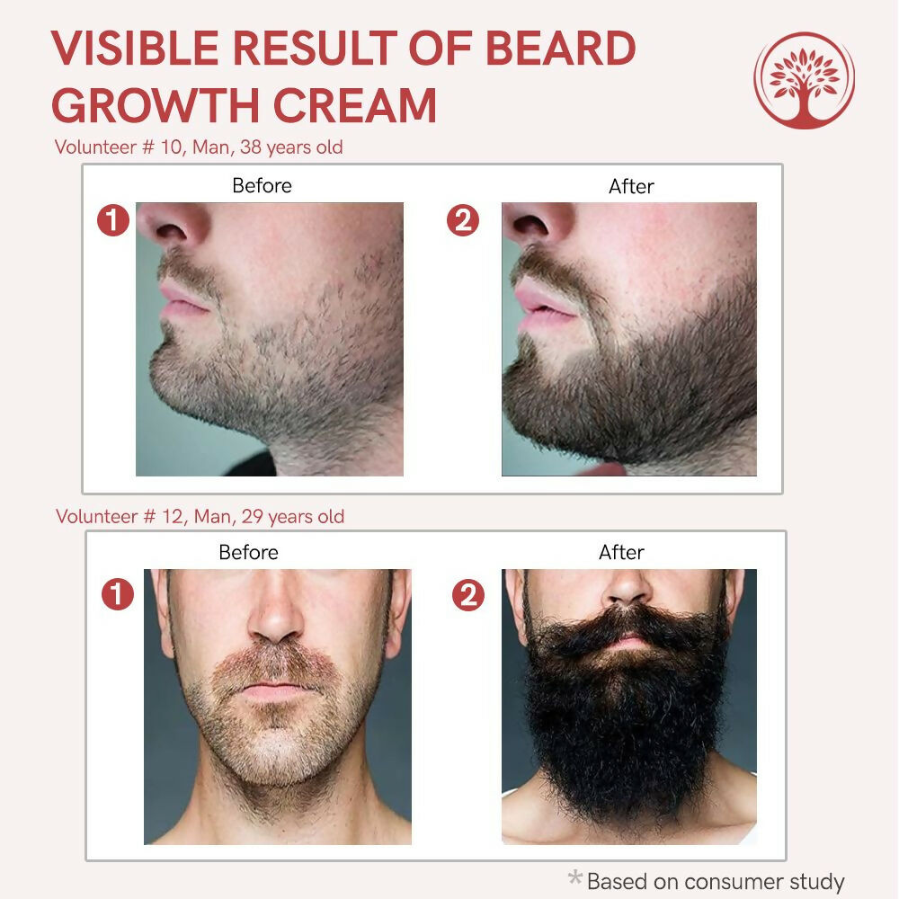 Ivory Natural Beard Growth Cream - Biotin Boosted Hair Follicle For New Hair Cycle