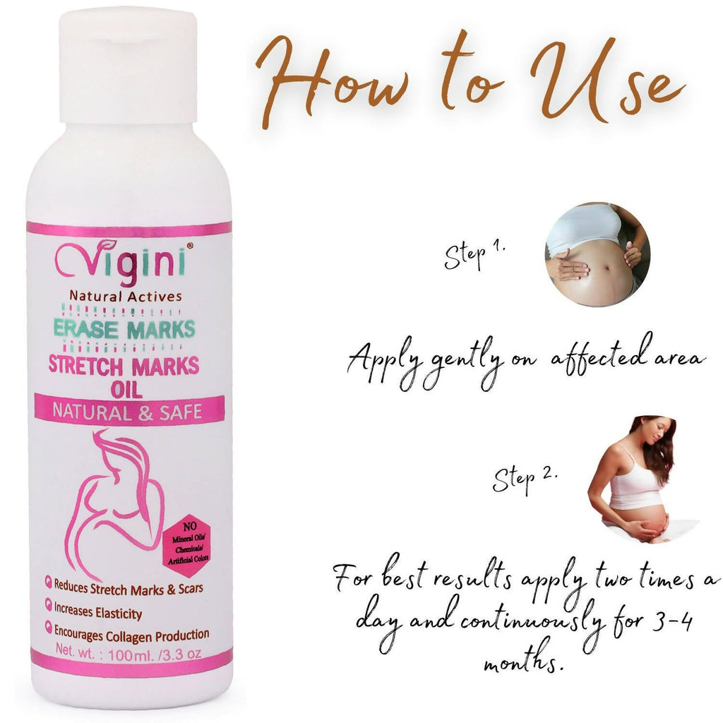 Vigini Natural Actives Stretch Marks Scars Removal Cream Oil