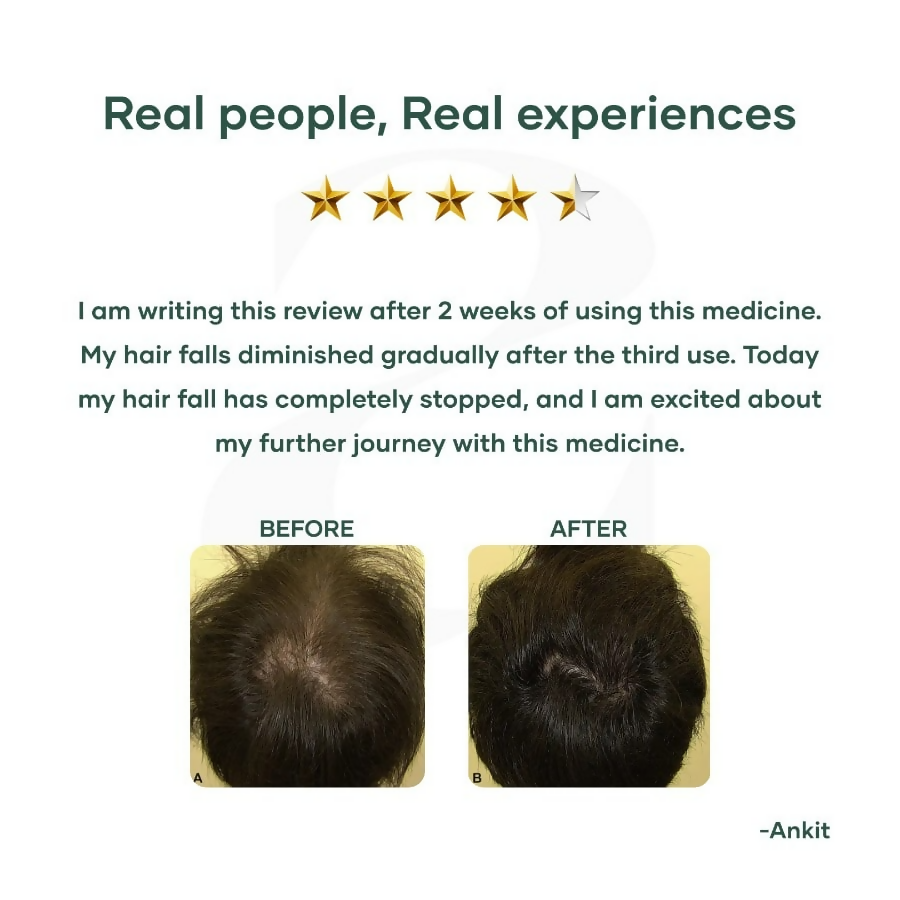 Mars By GHC Hair Regrowth Tablets